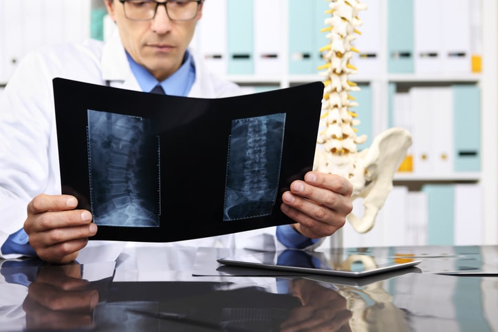 Spine Injury Law in NYC